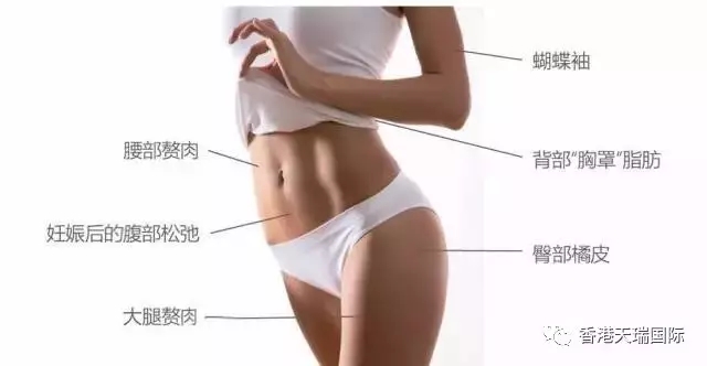 現(xiàn)下流行的BTL脂肪刀，有什么效果？