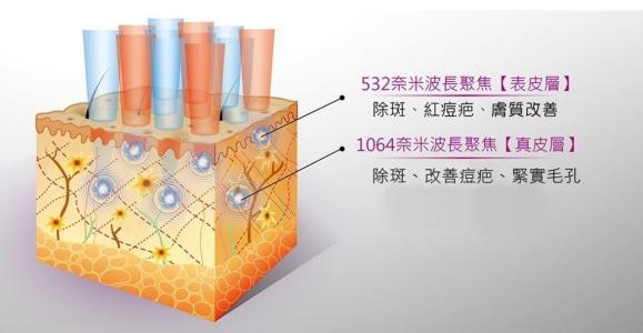 祛痘我用點陣，你呢？！