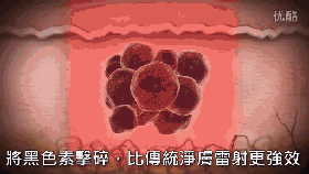 皮秒激光儀器的一些問題的解答！