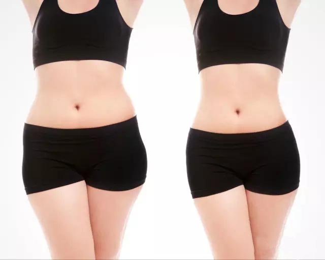 UltraShape優(yōu)立塑非侵入式專利科技、有效、安全！